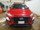 Used Park Assist Camera Fits: 2021 Hyundai Kona Windshield Mounted Lane. Fixed Price $145.90.