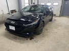 Passenger Camera/projector Radar Unit Rear Blind Spot Fits 21-23 Elantra 236615. Fixed Price $158.64.