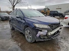 Used Park Assist Camera Fits: 2017 Acura Rdx Radar Unit Adaptive Cruise Behind G. Fixed Price $202.45.